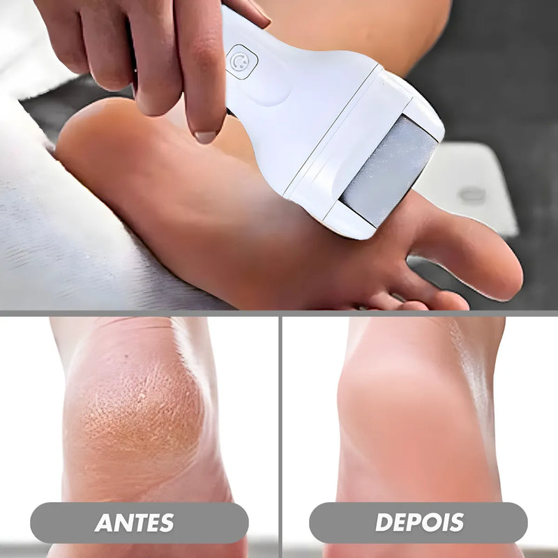 FeetCare Elite