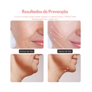 Massageador Facial LED Lift com Fototerapia